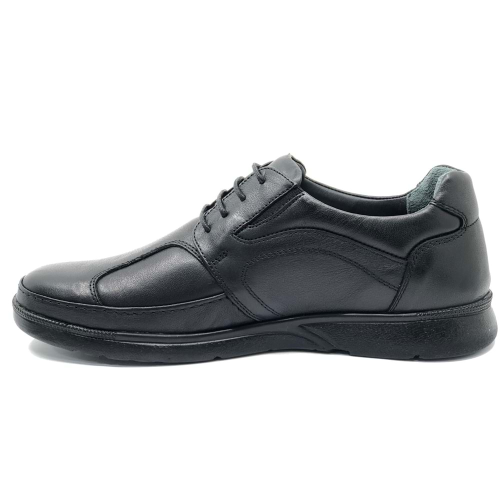 Forelli Broks (Bunyon) Kemik Çıkıntısına Özel Hakiki Deri Ortopedik Comfort Erkek Casual Ayakkabı